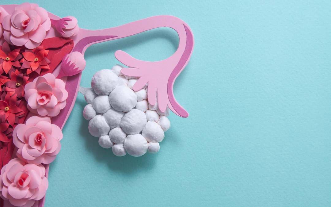 Your PCOD Guide: Causes, Symptoms & Treatment