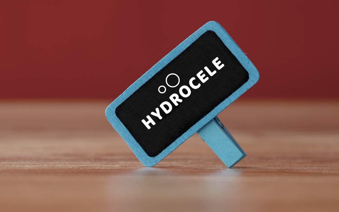 Suffering from Pain Downtown? Could be Hydrocele