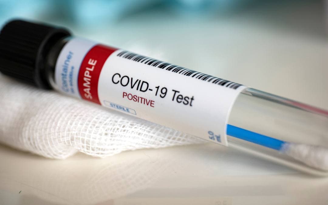 Tested Positive For COVID? Make Sure Your Loved Ones Are Safe With RT-PCR Test