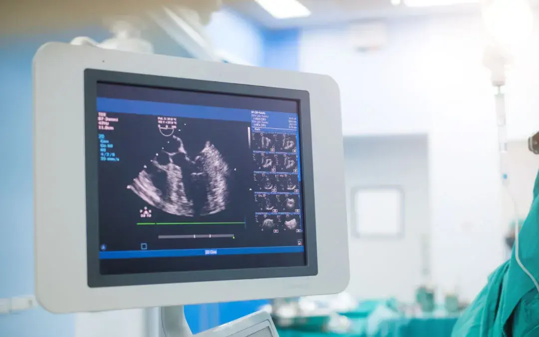 What is a 2D Echo Test?