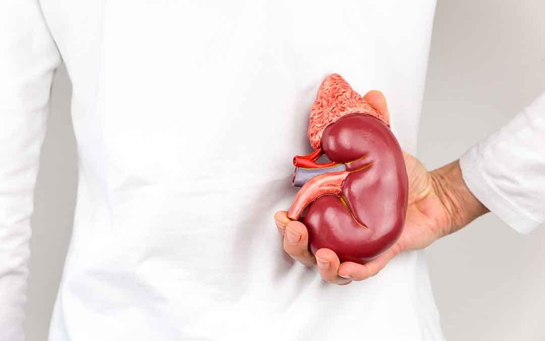 These Rocks, Don’t Rock! Understanding Kidney Stones