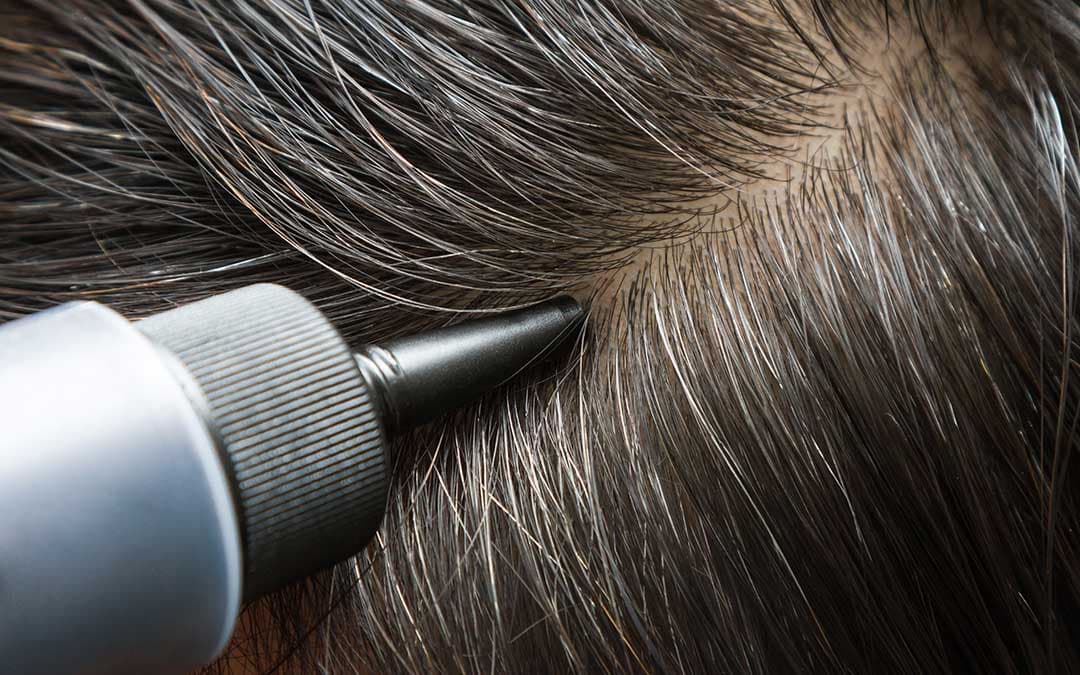 No More Grey: Tips to Stop Premature Greying