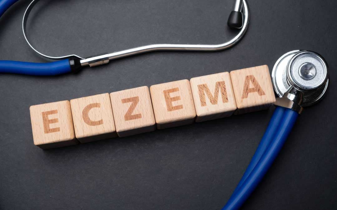 Eczema: Ditch the Itch with These Tips