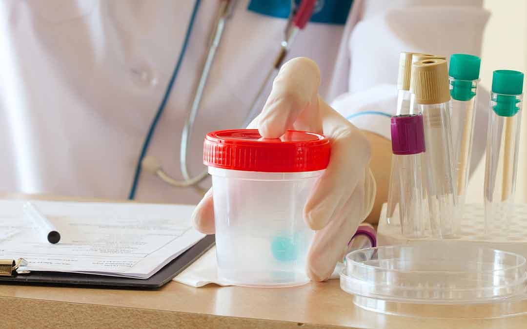 Why Should You Go For A Kidney Panel?