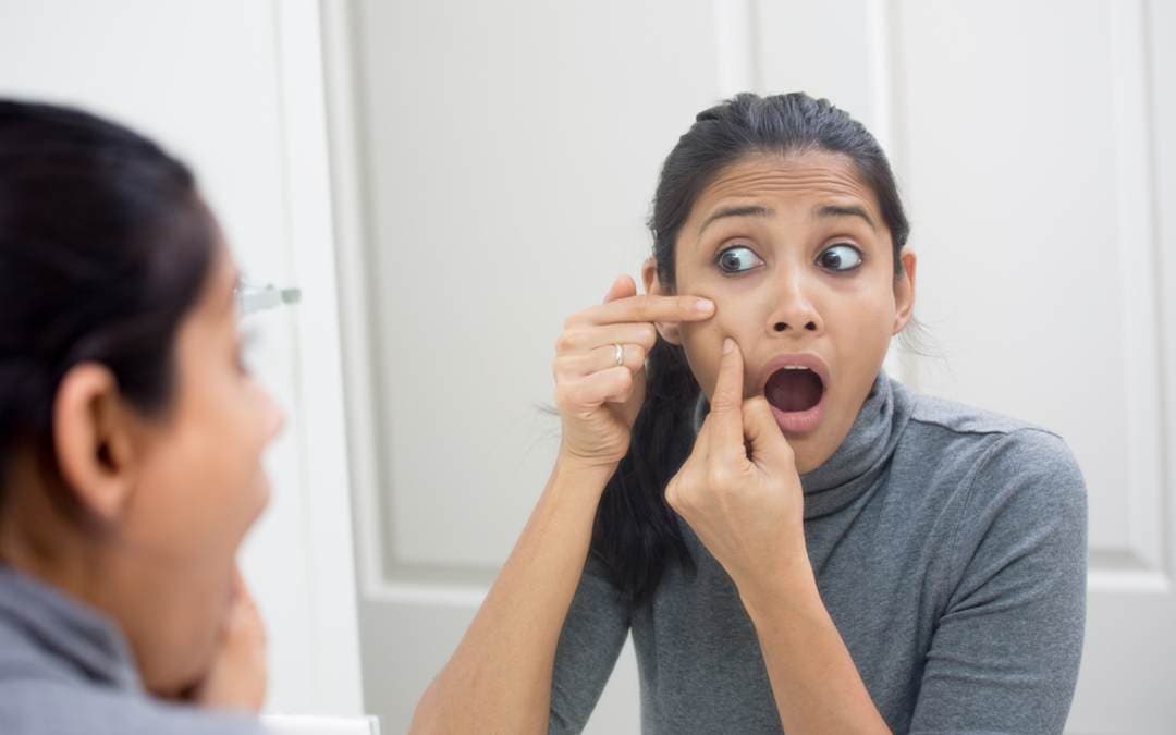 Causes and Treatment of Acne in Adults