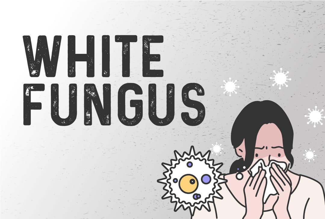 White Fungus in India: What Is It And How It Affects COVID-19 Patients