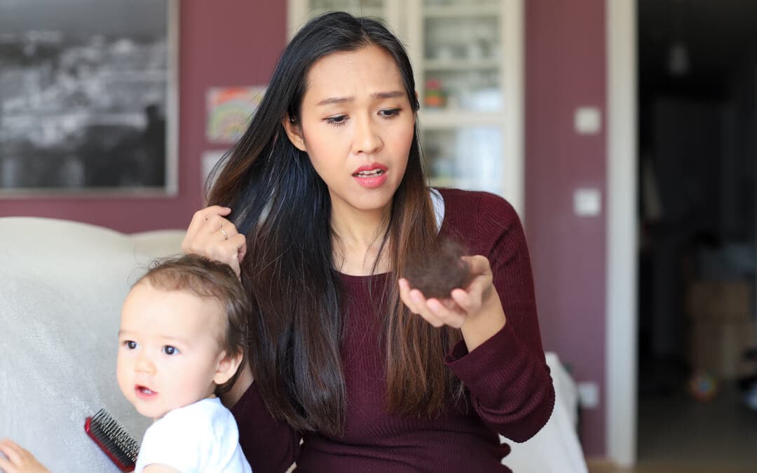 Causes And Treatment Of Hair Fall After Delivery