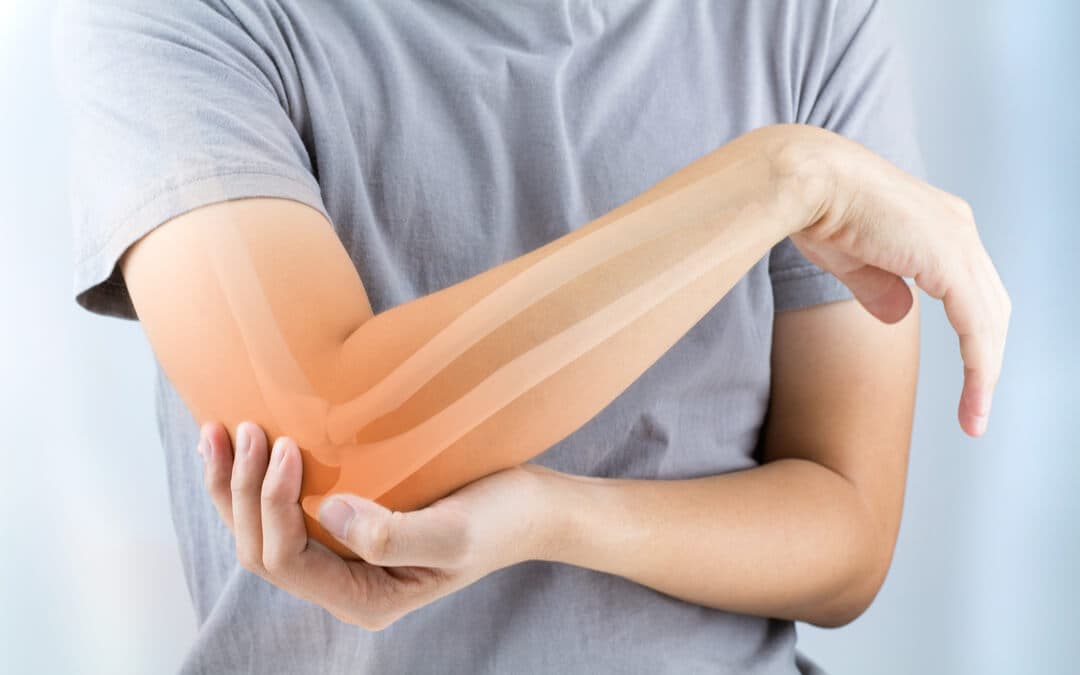 Osteoporosis Symptoms: 6 Myths And Facts