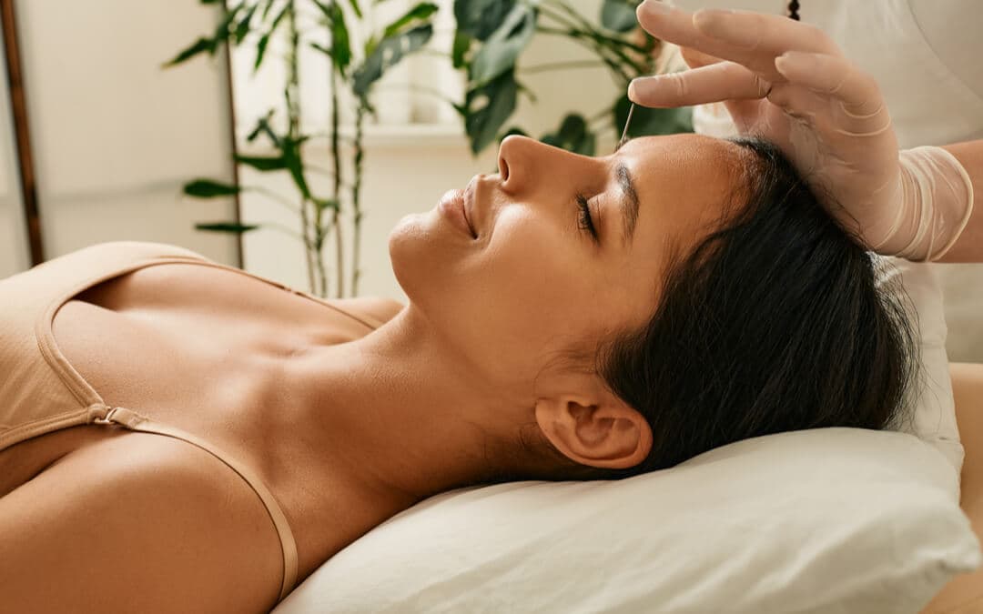 Acupressure Points For Migraines