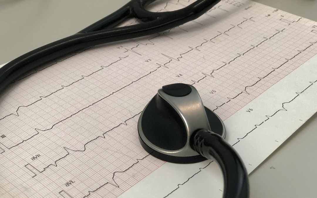 Why Is An ECG Done Before Surgery?