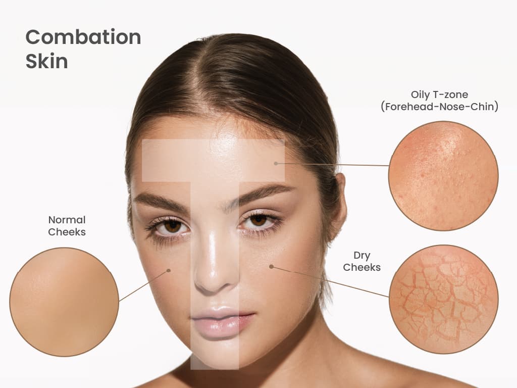 The Ultimate Guide To Skin Types, Problems and Solutions